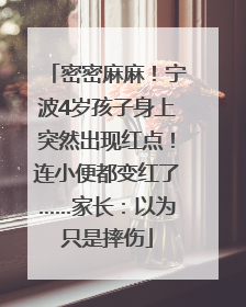 密密麻麻！宁波4岁孩子身上突然出现红点！连小便都变红了……家长：以为只是摔伤