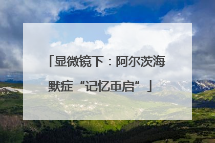 显微镜下：阿尔茨海默症“记忆重启”